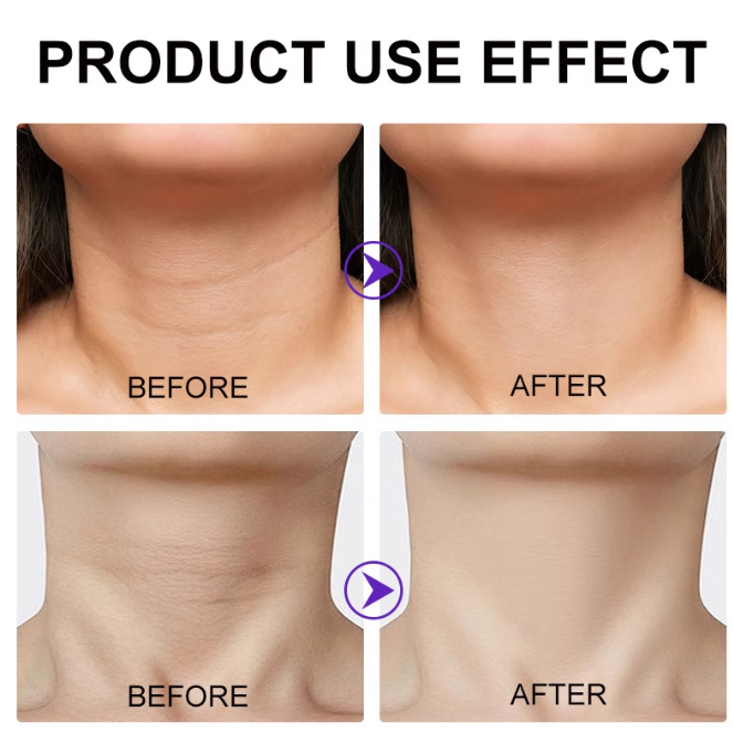 Youth-Guard™ Ultimate Neck Lift Cream